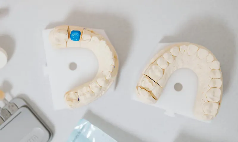 High-precision ceramic and zirconia dental crown restoration blocks used for CAD/CAM crown fabrication at Deekshu Dental Implant Center Bangalore