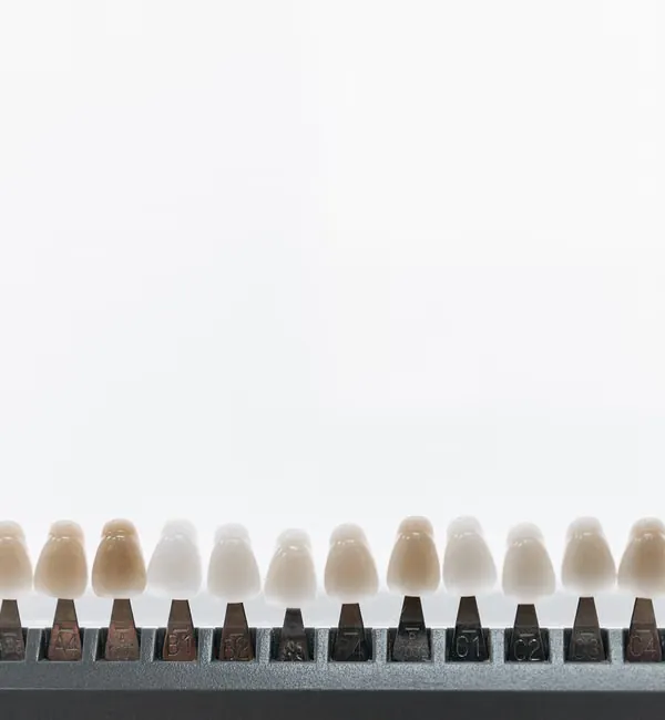 Dental shade guide for porcelain crown colour matching at Deekshu Dental Sarjapura Bangalore