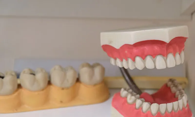Custom-made complete and partial dentures on display at Deekshu Dental Implant Center Sarjapura Bangalore