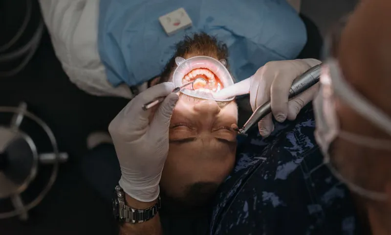 Restoring Your Smile, Health, and Confidence — Full Mouth Rehabilitation Sarjapura