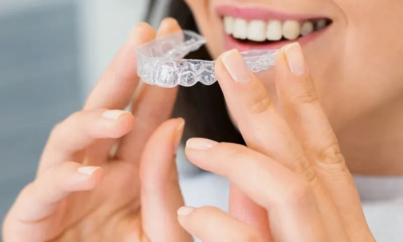 Benefits of Invisalign Treatment — Clear Aligners Sarjapura
