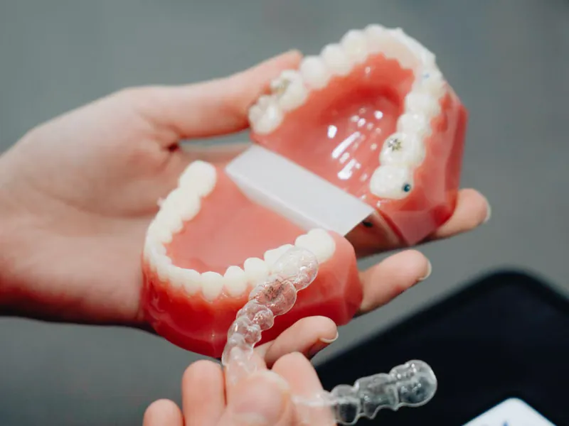 Invisalign Treatment Overview — Clear Aligners Sarjapura