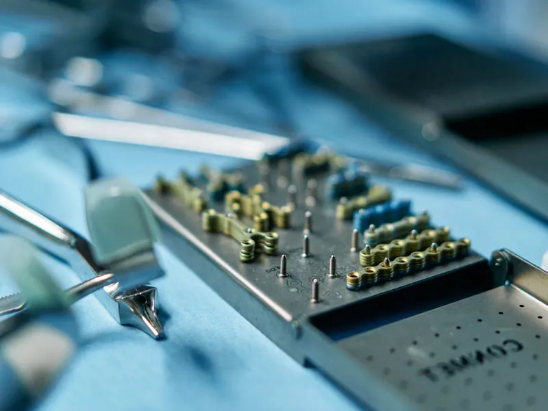 Close-up clinical dental model showing metal braces brackets used for orthodontic case study at Deekshu Dental Sarjapura